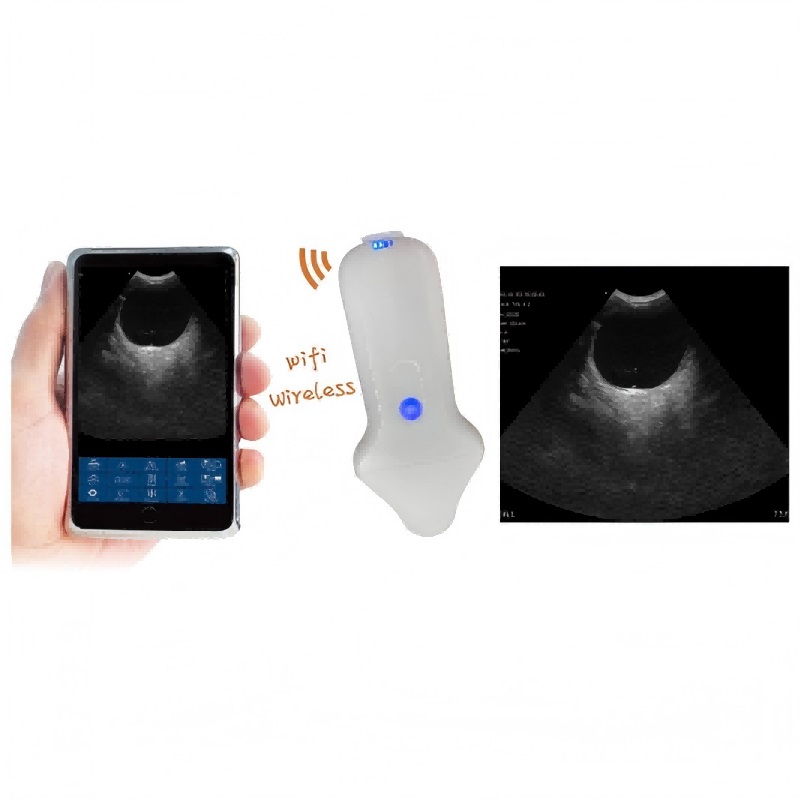 VC-3M Micro-convex Probe Type Wireless Color Doppler Scanner