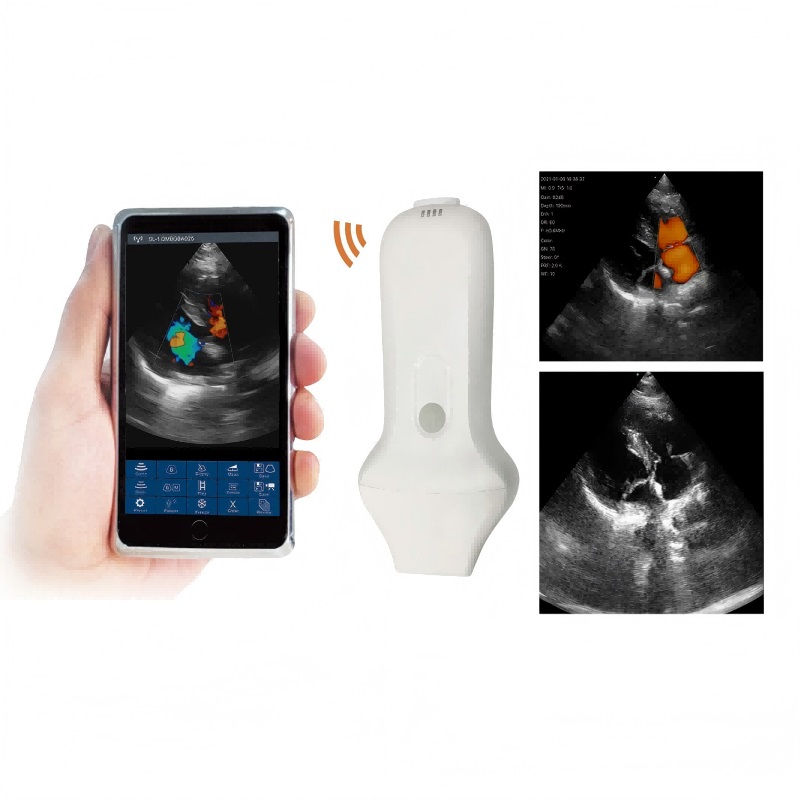 VC-4PA Phased Array Probe Type Wireless Color Doppler Scanner